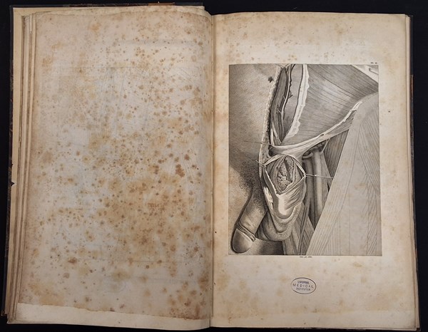 Lot 1485 - SCARPA, ANTOINE [ANTONIO]